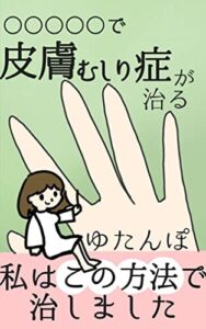 【無料で読める】○○○○○で皮膚むしり症が治る: 私はこの方法で治しました