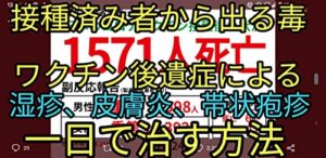 【無料で読める】コロナワクチン接種後の副反応や済みのスパイクタンパク質シェディングで体中に湿疹や皮膚炎、帯状疱疹ができたとき対処法。自分で治す方法。すぐに痒み痛みを止めれます。 (静心出版)