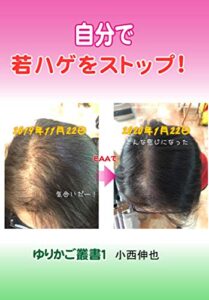 【無料で読める】自分で若ハゲをストップ！ ゆりかご叢書