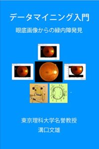 【無料で読める】データマイニング入門: 眼底画像からの緑内障発見