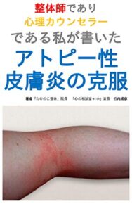 【無料で読める】アトピー性皮膚炎の克服～整体師、心理カウンセラーが書いた～