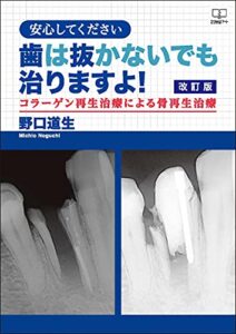 【無料で読める】改訂版安心してください歯は抜かないでも治りますよ! ：コラーゲン再生治療による骨再生治療（２２世紀アート）